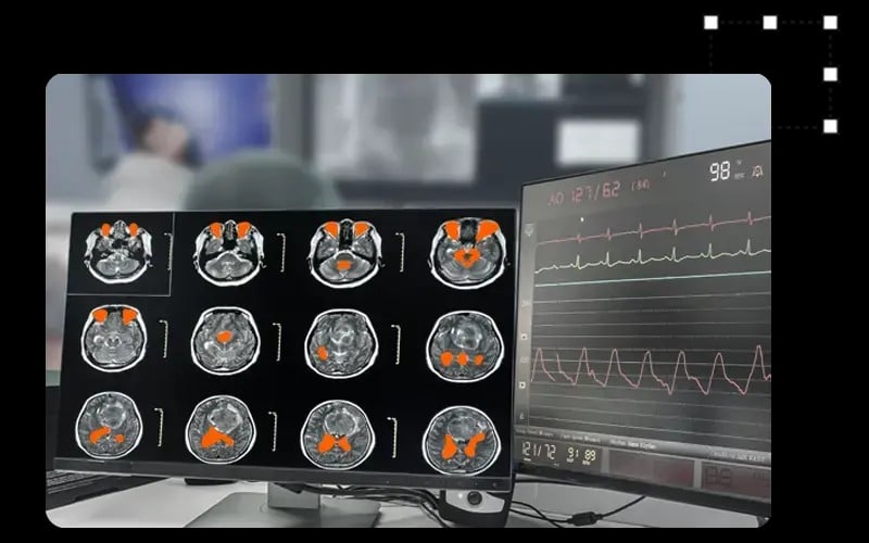 healthcare data annotation in use
